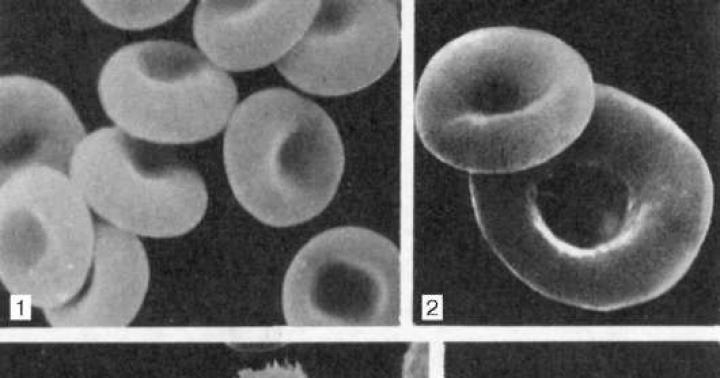 Blood, intercellular substance and lymph form ... Liquid connective tissue ... Blood and lymph belong to